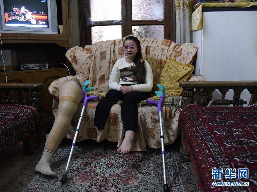 (國際·圖文互動)(1)通訊:戰爭給他們留下殘缺的童年——敘利亞危機9周年記